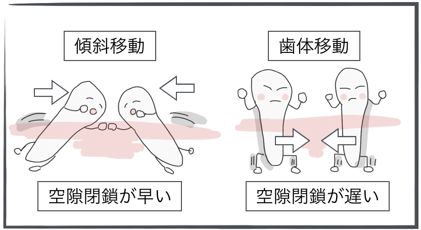 インビザライン交換のタイミングはどうやって決まるの？②