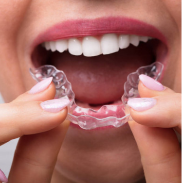 インビザラインで本当に歯並びが治るの？